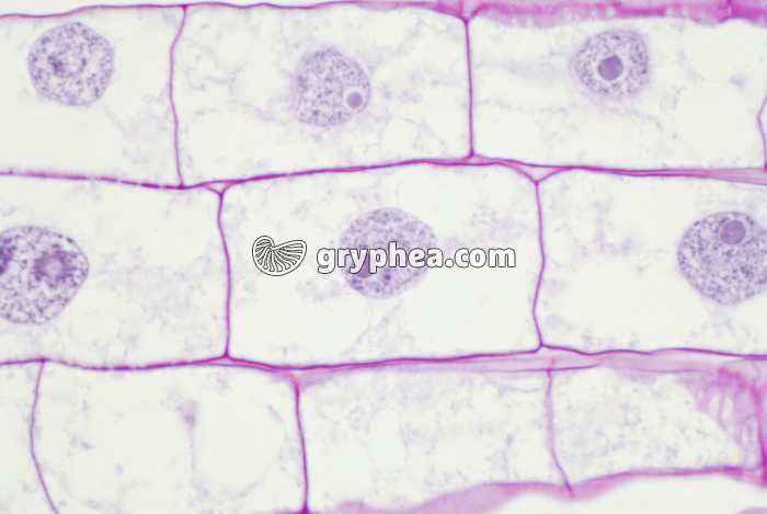Mitose dans une racine de Blé (interphase) x200 - gryphea.com